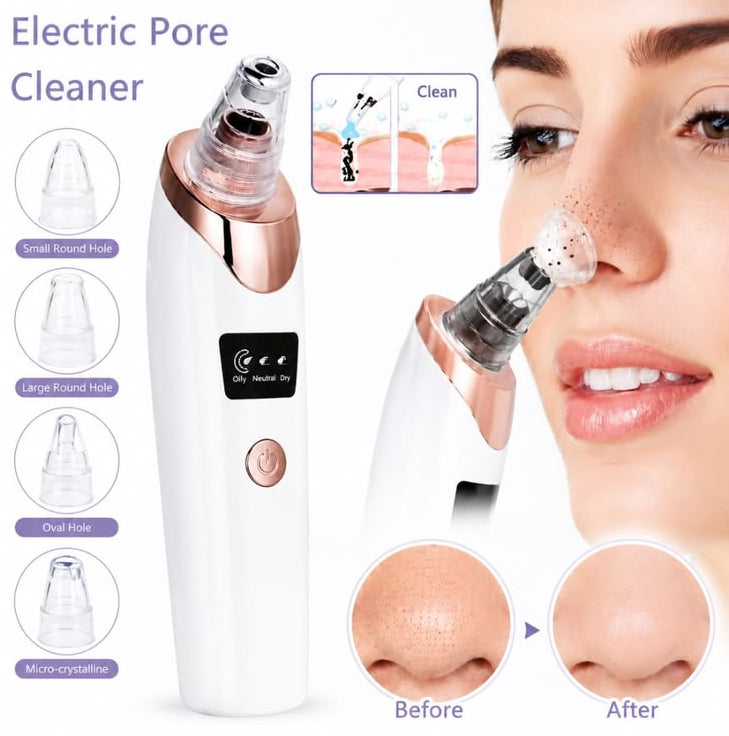 Digital Blackhead Remover Vacuum