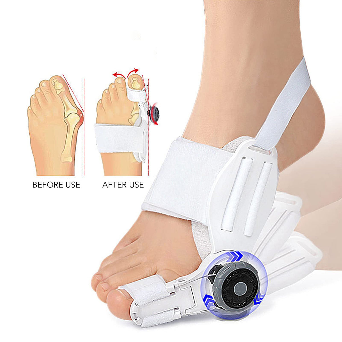 Adjustable Bunion Corrector Big Toe Straightener